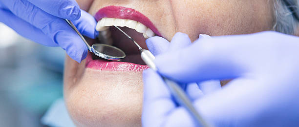 Best Emergency Dental Care for Broken or Chipped Teeth in Sedgwick, KS