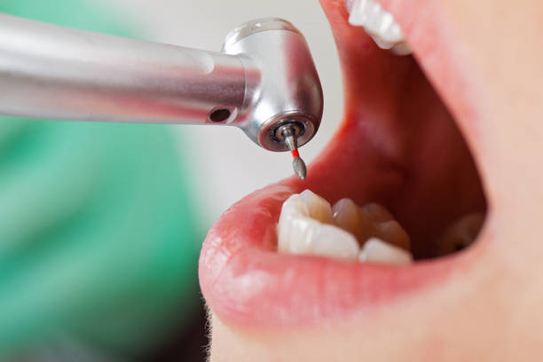 Best Urgent Care for Lost Fillings or Crowns in Sedgwick, KS